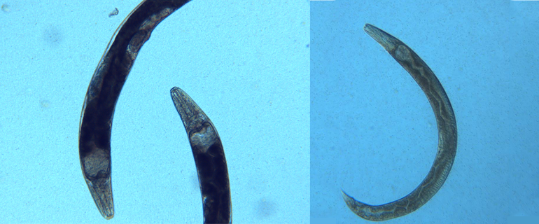 magnified parasite worms